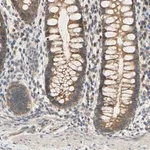 Merck Anti-MBTPS2 antibody produced in rabbit