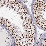Merck Anti-PPP4R3A antibody produced in rabbit