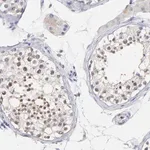 Merck Anti-SMARCA1 antibody produced in rabbit