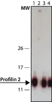 Merck Anti-Profilin 2 (C-terminal) antibody produced in rabbit