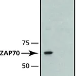 Merck Monoclonal Anti-ZAP-70 antibody produced in mouse
