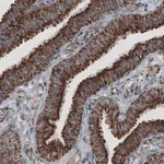 Merck Monoclonal Anti-CS antibody produced in mouse