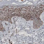 Merck Monoclonal Anti-CS antibody produced in mouse