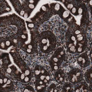 Merck Monoclonal Anti-CS antibody produced in mouse