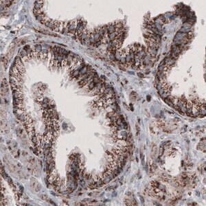 Merck Monoclonal Anti-CS antibody produced in mouse