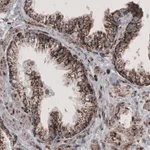 Merck Monoclonal Anti-CS antibody produced in mouse