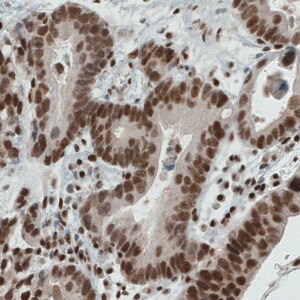 Merck Monoclonal Anti-ERCC1 antibody produced in mouse