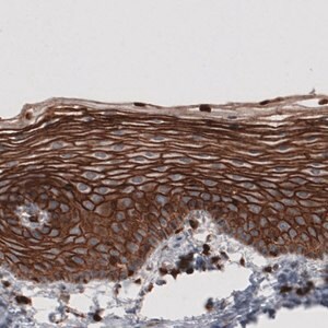 Merck Monoclonal Anti-EZR antibody produced in mouse