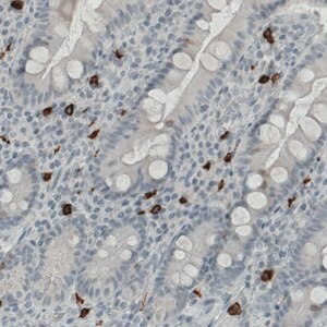 Merck Monoclonal Anti-KIT antibody produced in mouse