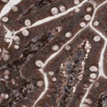 Merck Monoclonal Anti-GORASP2 antibody produced in mouse