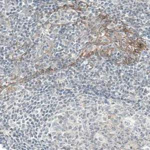 Merck Monoclonal Anti-EGFR antibody produced in mouse