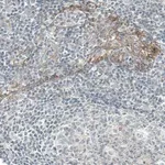 Merck Monoclonal Anti-EGFR antibody produced in mouse