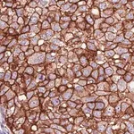Merck Monoclonal Anti-HER2 antibody produced in mouse