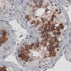 Merck Monoclonal Anti-LY6K antibody produced in mouse