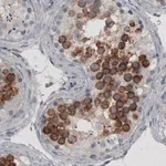 Merck Monoclonal Anti-LY6K antibody produced in mouse