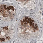 Merck Monoclonal Anti-LY6K antibody produced in mouse