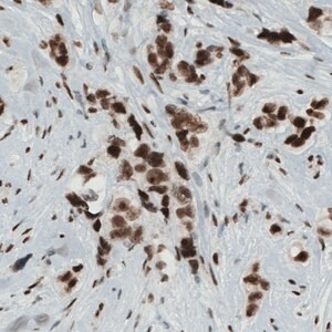 Merck Monoclonal Anti-KDM5B antibody produced in mouse