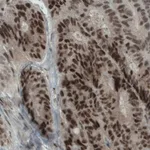 Merck Monoclonal Anti-NSD2 antibody produced in mouse