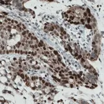 Merck Monoclonal Anti-NSD2 antibody produced in mouse