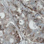 Merck Monoclonal Anti-MACC1 antibody produced in mouse