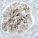 Merck Monoclonal Anti-PLA2R1 antibody produced in mouse