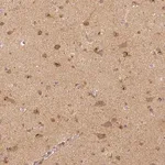 Merck Monoclonal Anti-RHOT1 antibody produced in mouse