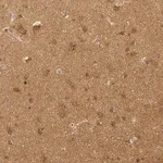 Merck Monoclonal Anti-RHOT1 antibody produced in mouse