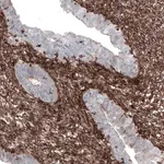 Merck Monoclonal Anti-ZYX antibody produced in mouse