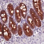 Merck Monoclonal Anti-ACSL5 antibody produced in mouse
