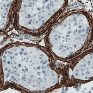 Merck Monoclonal Anti-FBN1 antibody produced in mouse