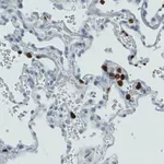 Merck Monoclonal Anti-MMP9 antibody produced in mouse
