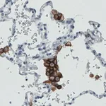 Merck Monoclonal Anti-MRC1 antibody produced in mouse