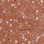 Merck Monoclonal Anti-TSPAN7 antibody produced in mouse