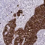 Merck Monoclonal Anti-HER2 antibody produced in mouse