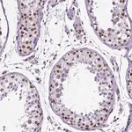 Merck Monoclonal Anti-REST antibody produced in mouse