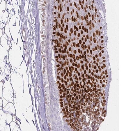 Merck Anti-HOXC13 antibody produced in rabbit
