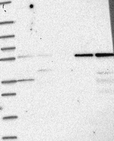 Merck Anti-IFIT1 antibody produced in rabbit