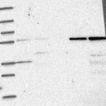 Merck Anti-IFIT1 antibody produced in rabbit