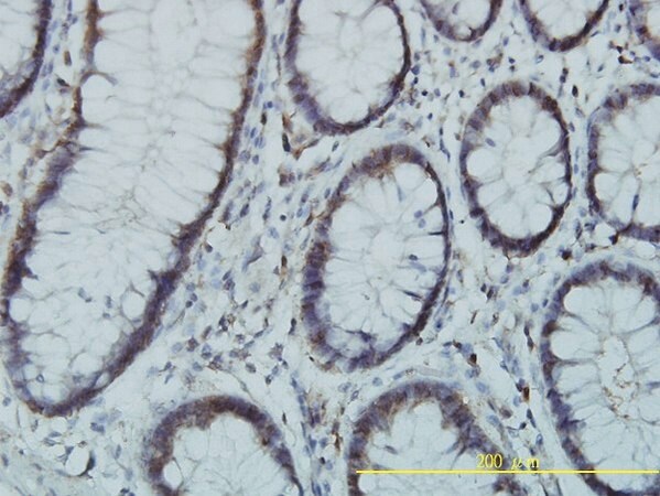 Merck Monoclonal Anti-PGM3 antibody produced in mouse