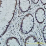 Merck Monoclonal Anti-PGM3 antibody produced in mouse