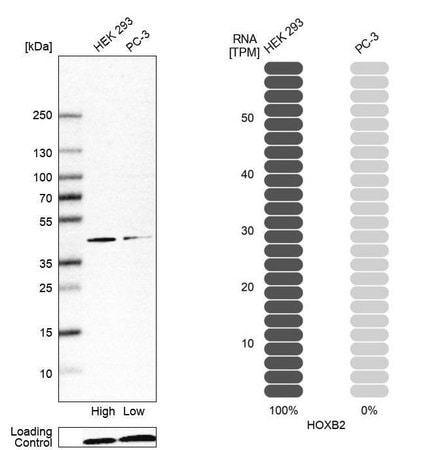 Merck Anti-HOXB2 antibody produced in rabbit