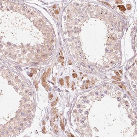 Merck Anti-FBXL14 antibody produced in rabbit