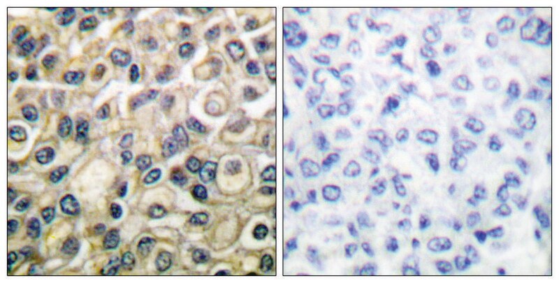 Merck Anti-Claudin 1 antibody produced in rabbit