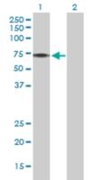 Merck ANTI-PINK1
