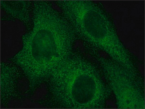 Merck Anti-Rab4 antibody produced in rabbit