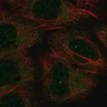 Merck Anti-CHODL antibody produced in rabbit