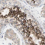 Merck Anti-FAM134A antibody produced in rabbit