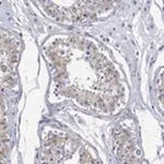 Merck Anti-ANKMY1 antibody produced in rabbit