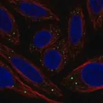 Merck Anti-C1GALT1C1 antibody produced in rabbit