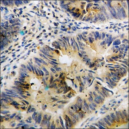 Merck Anti-phospho-FAK (pTyr397) antibody produced in rabbit